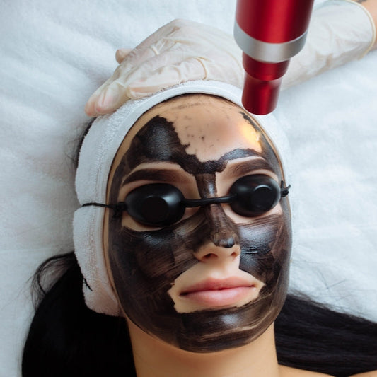 Carbon Peel