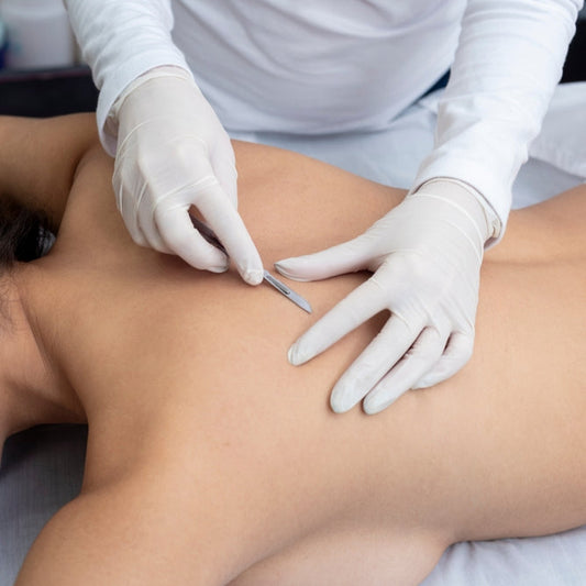 dermaplaning back